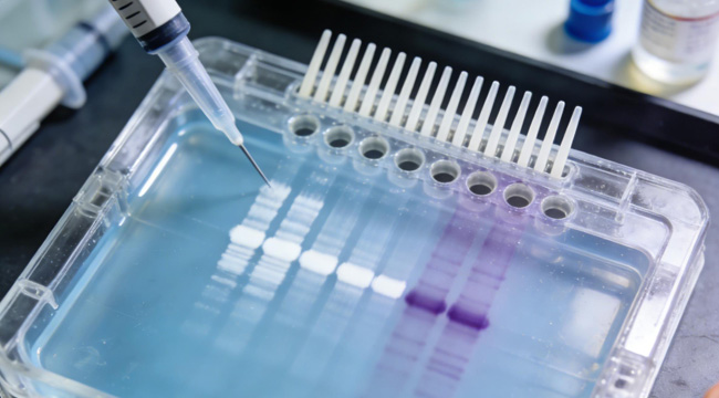 Protein Electrophoresis